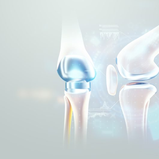 hip implant Medical poster, image of the bones of the knee, artificial joint in the knee. Arthritis, inflammation, fracture, cartilage,. Copy space, 3D illustration, 3D render